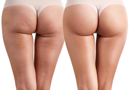 Ilustração do efeito do Butt Cream