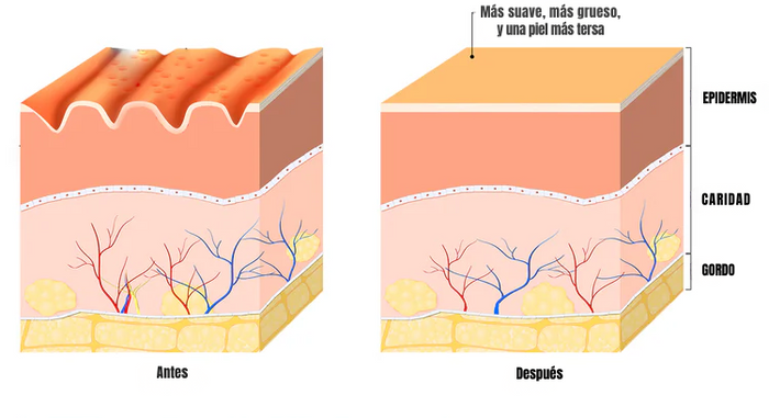 Ilustração do efeito do Butt Cream